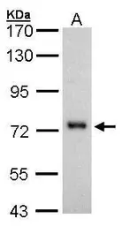 Anti-CD73 antibody [N3C3] used in Western Blot (WB). GTX101140