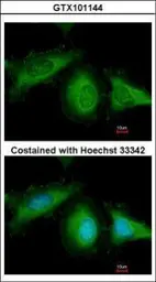 Anti-HSC70 antibody used in Immunocytochemistry/ Immunofluorescence (ICC/IF). GTX101144
