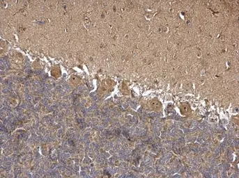 Anti-HSC70 antibody used in IHC (Paraffin sections) (IHC-P). GTX101144