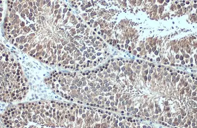 Anti-HSC70 antibody used in IHC (Paraffin sections) (IHC-P). GTX101144