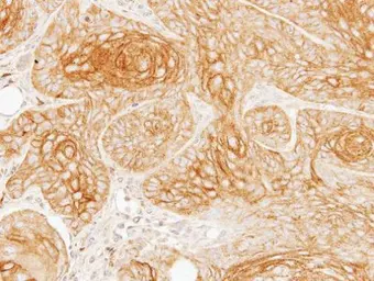 Anti-Galactosidase alpha antibody [N1C2] used in IHC (Paraffin sections) (IHC-P). GTX101178