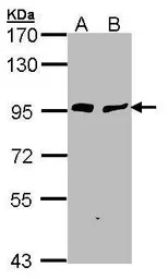 Anti-Gelsolin antibody [C2C3], C-term used in Western Blot (WB). GTX101185