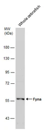 Anti-FYN antibody [N1N3] used in Western Blot (WB). GTX101189