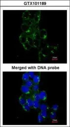 Anti-FYN antibody [N1N3] used in Immunocytochemistry/ Immunofluorescence (ICC/IF). GTX101189