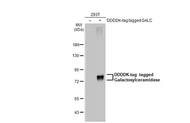 Anti-Galactosylceramidase antibody [N3C3] used in Western Blot (WB). GTX101197
