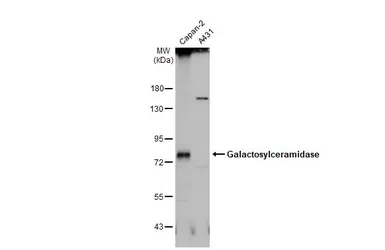 Anti-Galactosylceramidase antibody [N3C3] used in Western Blot (WB). GTX101197
