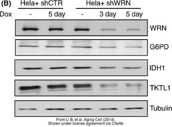 Anti-G6PD antibody used in Western Blot (WB). GTX101212