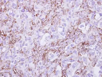 Anti-G6PD antibody used in IHC (Paraffin sections) (IHC-P). GTX101212