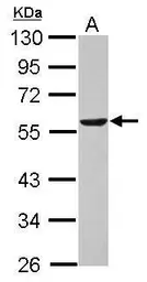 Anti-DLD antibody [N1N3] used in Western Blot (WB). GTX101232