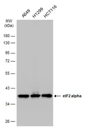 Anti-eIF2 alpha antibody [N1C3] used in Western Blot (WB). GTX101241