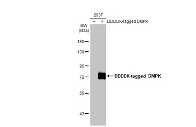 Anti-DMPK antibody used in Western Blot (WB). GTX101248