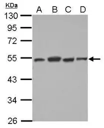 Anti-Dysbindin antibody used in Western Blot (WB). GTX101252