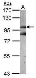 Anti-beta Catenin antibody used in Western Blot (WB). GTX101254