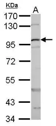 Anti-beta Catenin antibody used in Western Blot (WB). GTX101254