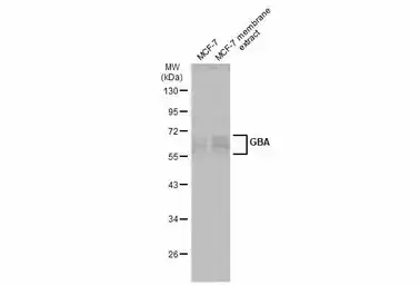 Anti-GBA antibody [C1C3] used in Western Blot (WB). GTX101267
