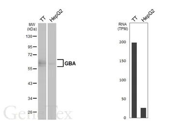 Anti-GBA antibody [C1C3] used in Western Blot (WB). GTX101267