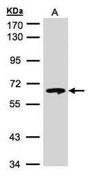 Anti-GBA antibody [C1C3] used in Western Blot (WB). GTX101267