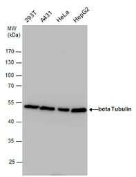 Anti-beta Tubulin antibody used in Western Blot (WB). GTX101279