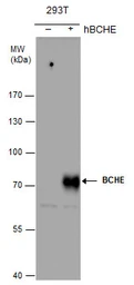 Anti-BCHE antibody [N1N3] used in Western Blot (WB). GTX101304