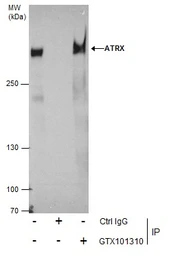 Anti-ATRX antibody [C3], C-term used in Immunoprecipitation (IP). GTX101310