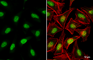 Anti-ATRX antibody [C3], C-term used in Immunocytochemistry/ Immunofluorescence (ICC/IF). GTX101310