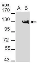 Anti-AXL antibody [C2C3], C-term used in Western Blot (WB). GTX101345