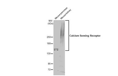 Anti-Calcium Sensing Receptor antibody used in Western Blot (WB). GTX101348