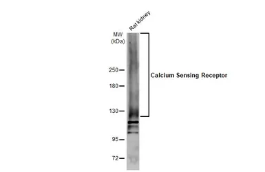 Anti-Calcium Sensing Receptor antibody used in Western Blot (WB). GTX101348