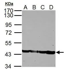 Anti-alpha Skeletal Muscle Actin antibody used in Western Blot (WB). GTX101362