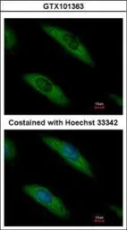 Anti-Aldolase B antibody used in Immunocytochemistry/ Immunofluorescence (ICC/IF). GTX101363