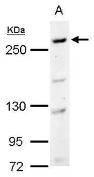 Anti-CAD antibody [C2C3], C-term used in Western Blot (WB). GTX101401