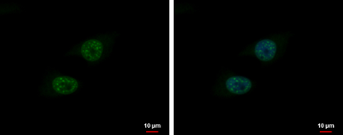 Anti-BLM antibody [N1N2], N-term used in Immunocytochemistry/ Immunofluorescence (ICC/IF). GTX101403
