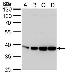Anti-Aldolase A antibody used in Western Blot (WB). GTX101408