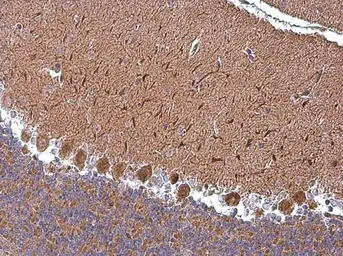 Anti-ABAT antibody used in IHC (Paraffin sections) (IHC-P). GTX101413