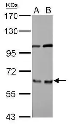 Anti-EIF3D antibody used in Western Blot (WB). GTX101424