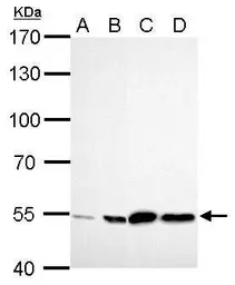 Anti-ALDH2 antibody used in Western Blot (WB). GTX101429