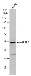 Anti-ALDH2 antibody used in Western Blot (WB). GTX101429