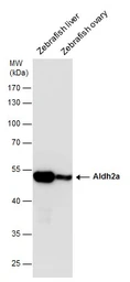 Anti-ALDH2 antibody used in Western Blot (WB). GTX101429