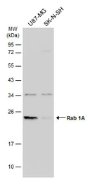 Anti-Rab 1A antibody [N1C3] used in Western Blot (WB). GTX101454