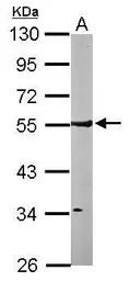 Anti-ARHGAP1 antibody [N3C3] used in Western Blot (WB). GTX101471