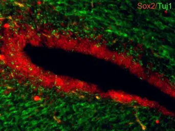 Anti-SOX2 antibody used in IHC (Frozen sections) (IHC-Fr). GTX101506
