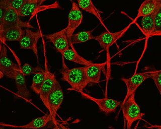 Anti-SOX2 antibody used in Immunocytochemistry/ Immunofluorescence (ICC/IF). GTX101506