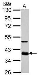 Anti-SOX2 antibody used in Western Blot (WB). GTX101506