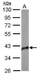 Anti-SOX2 antibody used in Western Blot (WB). GTX101506