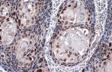 Anti-SOX2 antibody [N1C3] used in IHC (Paraffin sections) (IHC-P). GTX101507