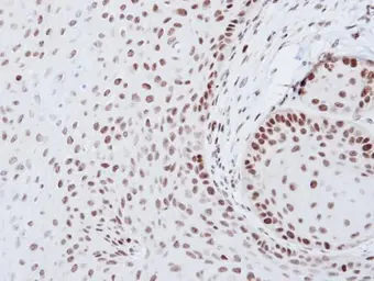 Anti-SOX2 antibody [N1C3] used in IHC (Paraffin sections) (IHC-P). GTX101507