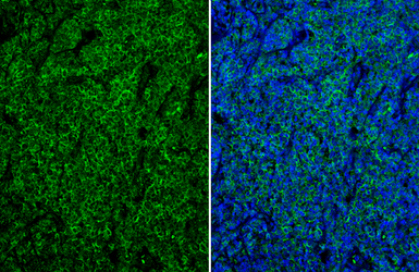 Anti-CD19 antibody [C1C3] used in IHC (Paraffin sections) (IHC-P). GTX101512
