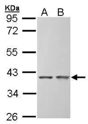 Anti-SGTA antibody used in Western Blot (WB). GTX101532