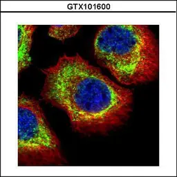 Anti-alpha Adducin antibody used in Immunocytochemistry/ Immunofluorescence (ICC/IF). GTX101600