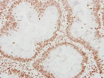 Anti-ADAR1 antibody [N3C1], Internal used in IHC (Paraffin sections) (IHC-P). GTX101602